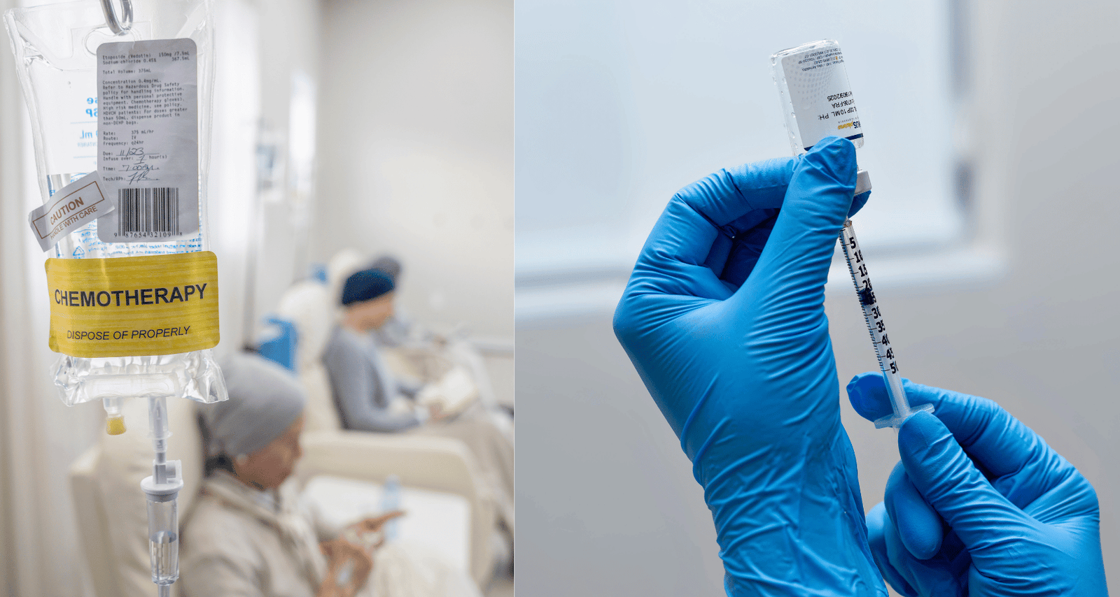 Chemotherapy infusion and immunotherapy treatment representing modern cancer care by Dr. Ayush Dubey, Best Oncologist in Raipur.