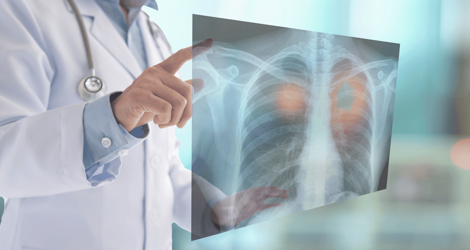 Lung cancer diagnosis and treatment illustration by Dr. Ayush Dubey, Best Oncologist in Raipur.