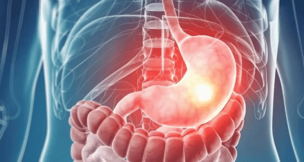 Gastro-intestinal Cancers: Everything You Need To Know