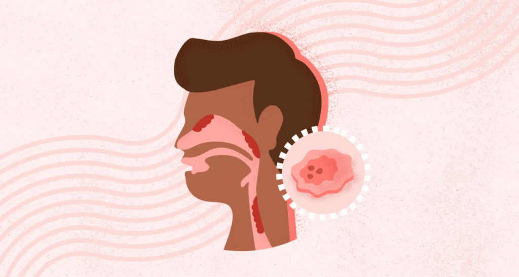 What are Head & Neck Cancers? Can they be Treated?
