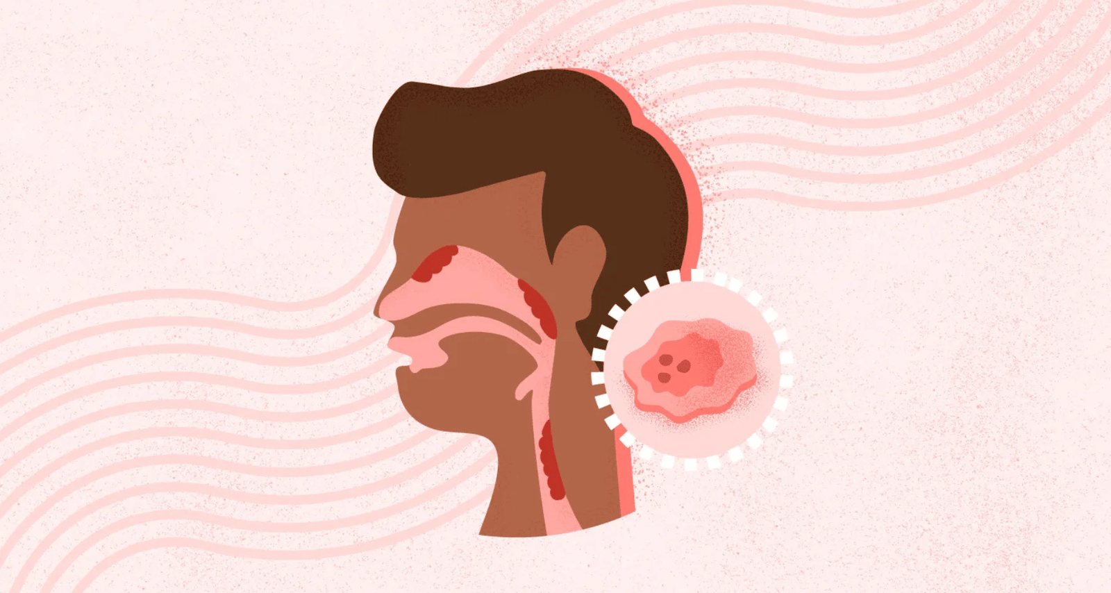 What are Head & Neck Cancers? Can they be Treated?